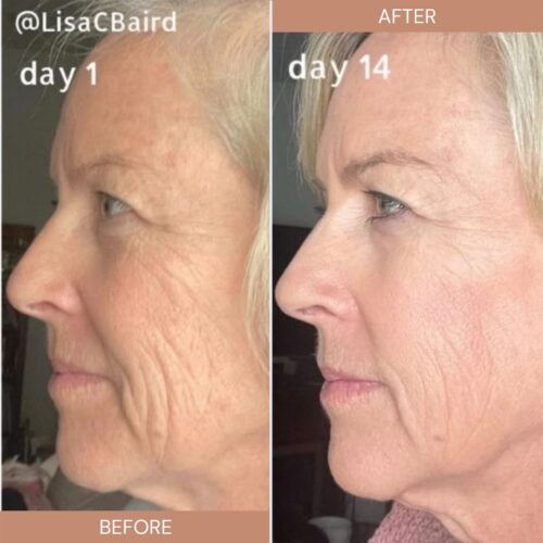 How Medical Grade Liquid Collagen Can Help Reverse the Clock JANUARY HART